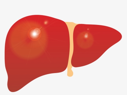 Liver Clipart Cirrhosis, Liver Cirrhosis Transparent - Liver Clipart, HD Png Download, Free Download