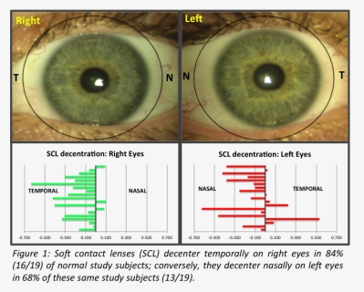 Different Between Left And Right Eye, HD Png Download, Free Download