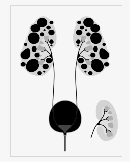 Polycystic Kidney Cartoon, HD Png Download, Free Download