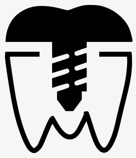 Premolar Crown Implant - Implant, HD Png Download, Free Download