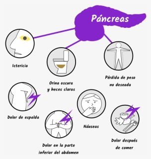 Dolor De Pancreas , Png Download - Cancer De Pancreas Sintomas, Transparent Png, Free Download
