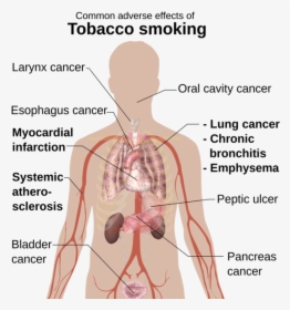 Benefit Of Vaping Marijuana - Common Adverse Effects Of Tobacco Smoking, HD Png Download, Free Download