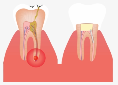 Anatomia Macroscopica Png - Root Canal, Transparent Png, Free Download