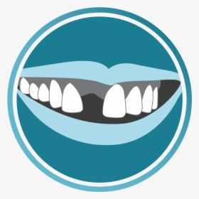 Clipart Smile Brace - Dentistry, HD Png Download, Free Download